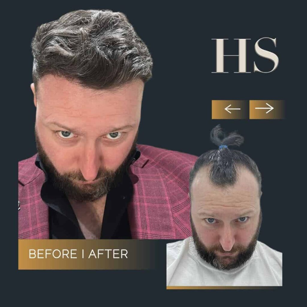 Home 7 Home 5
